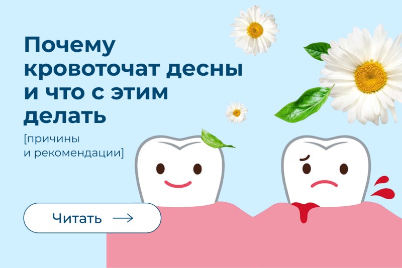 Почему кровоточат десны и что с этим делать: причины, лечение и профилактика