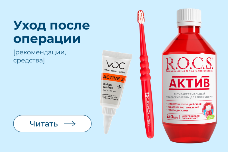 Уход за полостью рта после имплантации, удаления зуба и других операций в полости рта Уход за полостью рта после имплантации, удаления зуба и других операций в полости рта
