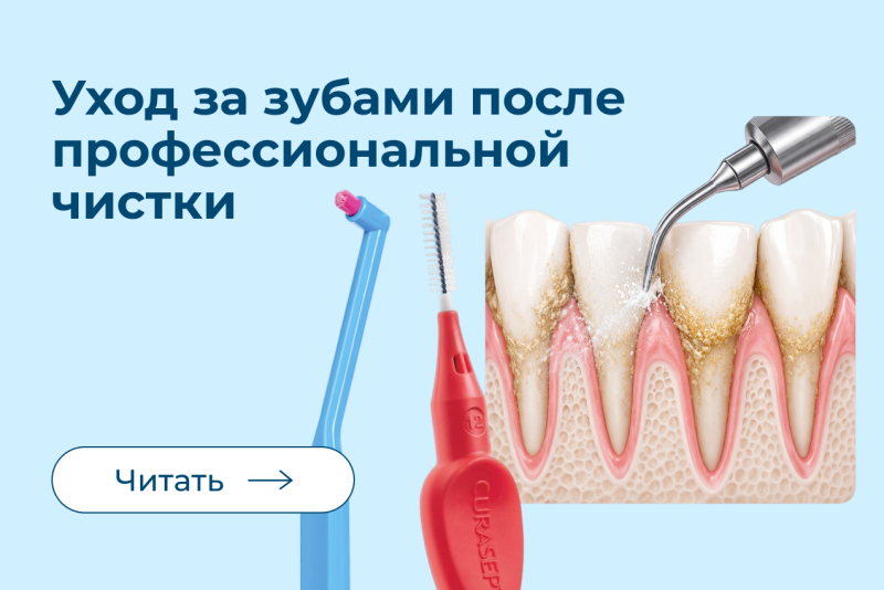 Как ухаживать за зубами после профессиональной чистки