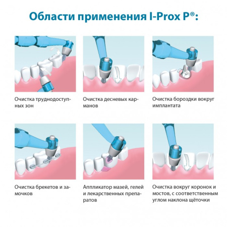 Монопучковая щетка Miradent I-Prox P transparent Pink (ручка + 4 насадки)РОЗОВАЯ