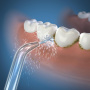Стандартные насадки для ирригаторов WaterPik JT-100E/JT-450E (2 шт) Стандартные насадки для ирригаторов WaterPik JT-100E/JT-450E (2 шт)