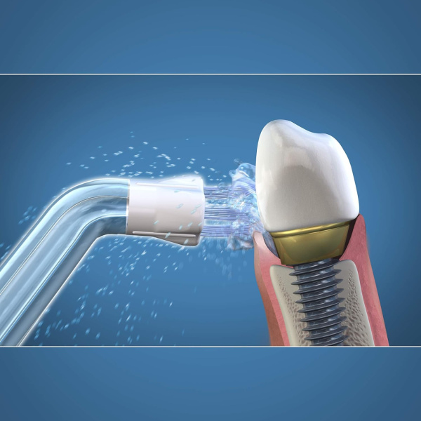 Насадки для имплантов для ирригаторов WaterPik PS-100E (2 шт)